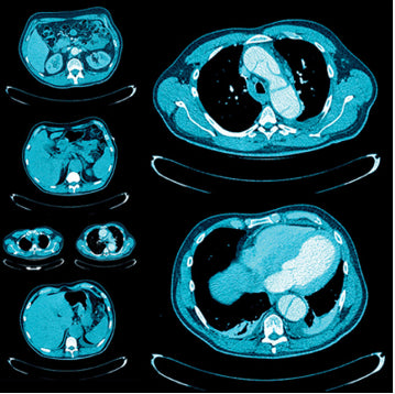 UCSF Abdominal and Thoracic Imaging 2025 (Videos + Slides PDFs)