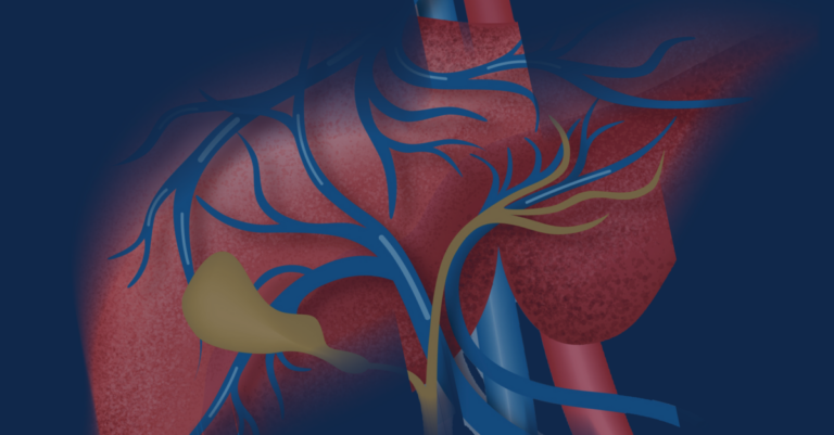 Michigan Medicine 27th Annual Liver Disease Wrap-Up 2024